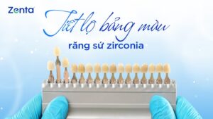 Tiết lộ bảng màu răng sứ zirconia