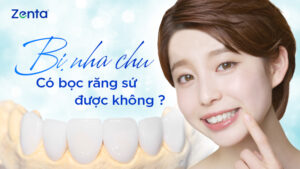 bi nha chu co boc rang su duoc khong
