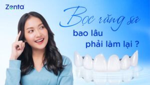boc rang su bao lau thi phai lam lai