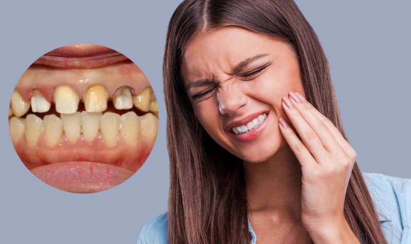 làm răng sứ sau bao lâu thì hết ê buốt