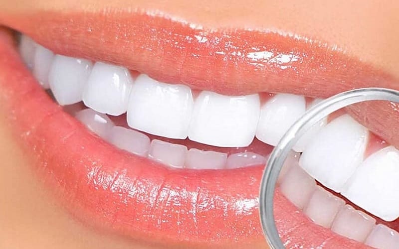 làm răng sứ sau bao lâu thì hết ê buốt