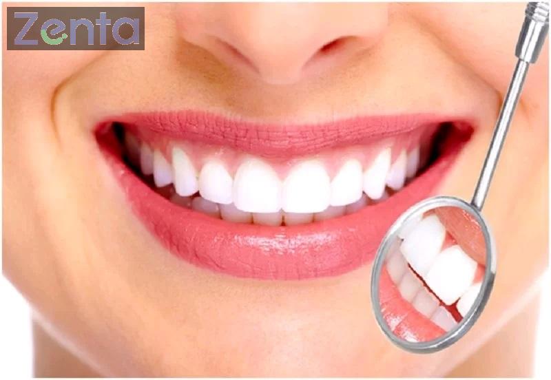 bọc răng sứ có bền không