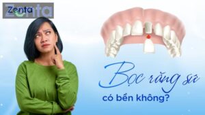 Bọc răng sứ có bền không