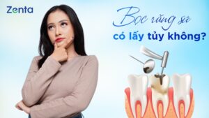 Bọc răng sứ có lấy tủy không