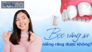 Bọc răng sứ có niềng răng được không