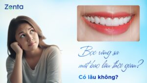Bọc răng sứ mất bao lâu